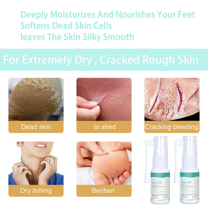 Spray Esfoliante Corpo, Mãos e Pés, Alivia a Pele Morta, Esfolia Hidrata e Limpa Profundamente_voghion.com