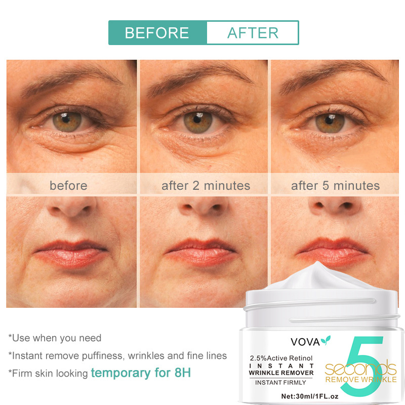 2-5 stk. retinol øyeblikkelig rynkefjerningskrem 5 sekunder løft fast anti-aldring forbedrer poser falmer fine linjer ansiktspleieprodukt_voghion.com