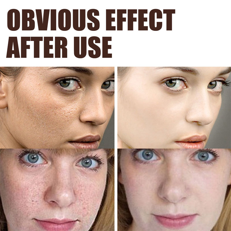 Rynkefjerner Retinol Ansigtscreme Anti-aging Falmende Fine Linjer Hudpleje Hyaluronsyre Fugtgivende Glat Koreansk B_voghion.com