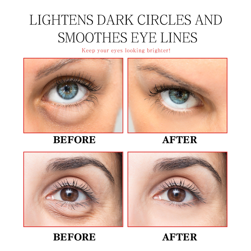 Eye Serum for Dark Circle and Wrinkles Bags Removal Lifting Firming Essence Anti Puffiness Reduce Fine Lines Eye Skin Care_voghion.com