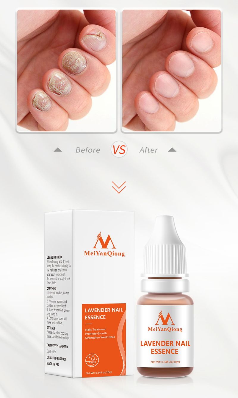 OLIO ESSENZIALE PER UNGHIE ALLA LAVANDA - 10 ml Cura naturale delle cuticole, idratazione e riparazione per unghie secche e fragili - Trattamento portatile per unghie da donna_voghion.com
