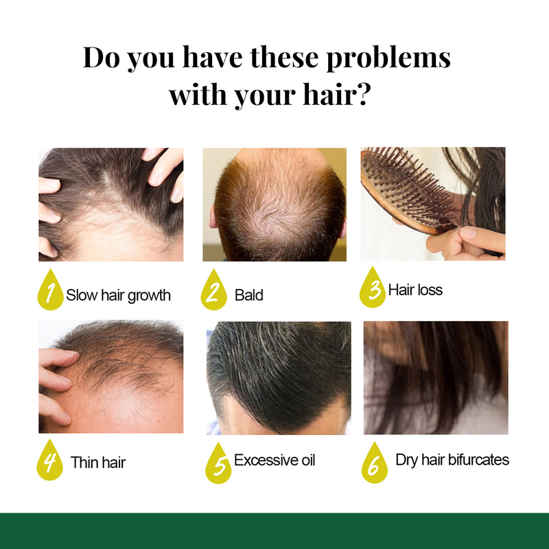 Eelhoe ingverikasvusprei, tugevatele juustele, massaažipeanahale, tihe, pinguldav, juuste väljalangemise ennetav, taastav ja toitev vedelik_voghion.com