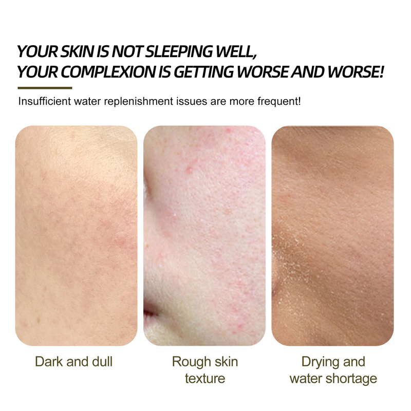 EELHOE Cleansing Willow Bark-essentie kan de droogheid verlichten, acnevlekken vervagen, de huid reinigen, hydrateren en een gevoelige huid veroorzaken_voghion.com