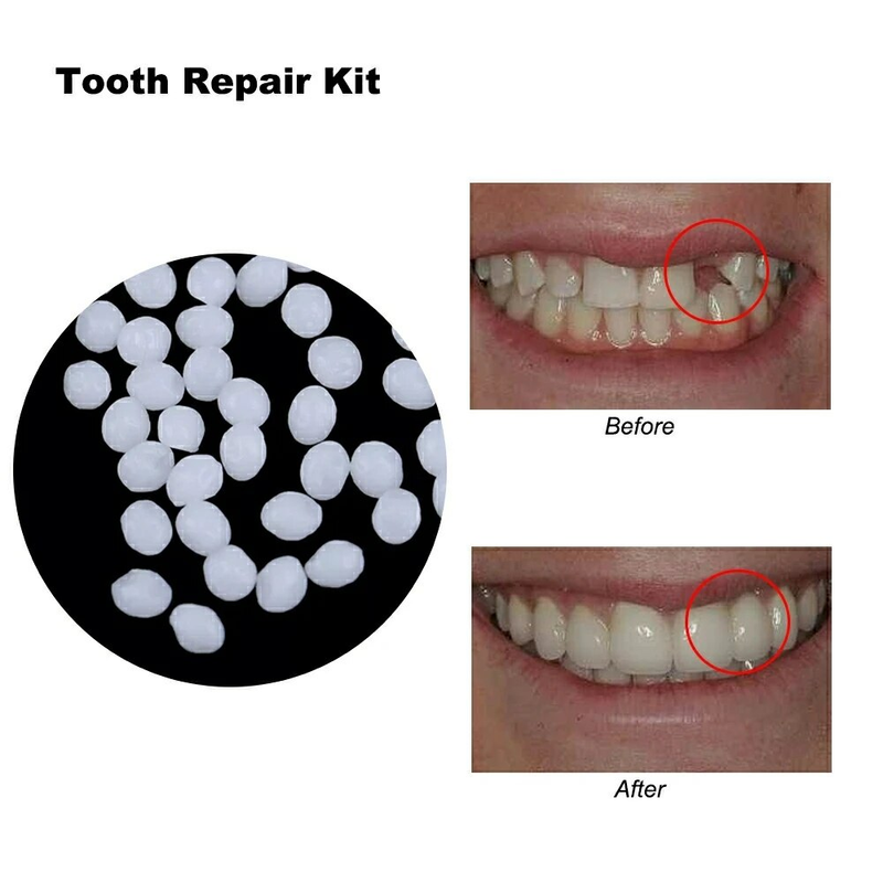Pegamento para reparación dental de 30-50g, adhesivo para dentadura postiza temporal, relleno de dentadura postiza, pegamento sólido moldeable, herramienta para el cuidado dental_voghion.com