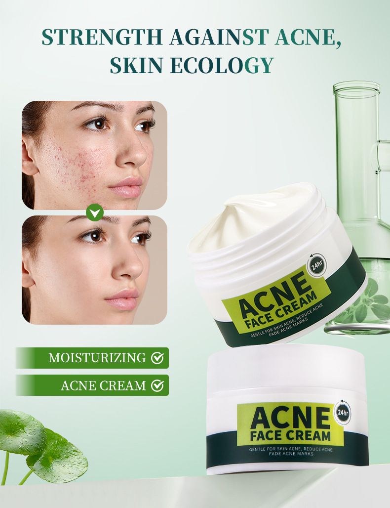 Treatments & Masks Anti Acne Facial Cream Moisturizing And Rejuvenating Acne Cream Facial Care_voghion.com