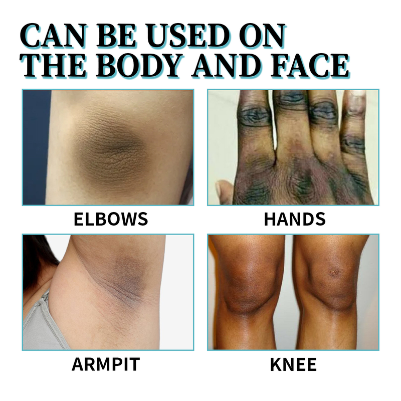 Cremă reparatoare OUHOE Black Thorny Skin pentru piele ternă, piele închisă la culoare la articulația genunchiului subrațului, hidratantă, curățătoare, reparatoare_voghion.com