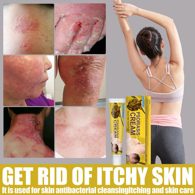 South Moon Repair Moss and Sweat Spot Topical Application Ointment Skin Antipruritus Cream_voghion.com