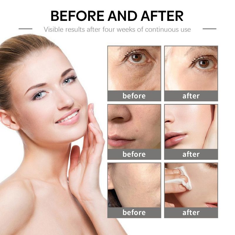 La crema hidratante EELHOE puede reducir las arrugas, la sequedad, hidratar la piel, aclarar el tono de la piel y prevenir el envejecimiento._voghion.com