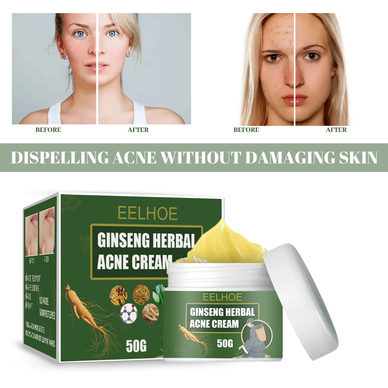 EELHOE augu krēms, noņemot, pret pinnēm, mitrinošs, attīrošs sejas krēms, eļļas un ūdens līdzsvara noņēmējs pret pinnēm_voghion.com