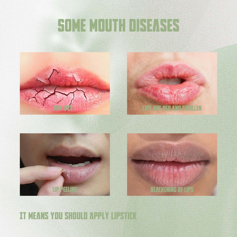 Hoygi Remove Dark Lip Balm, It Moisturizes Lips Membranes Prevent Weather-Shack Lip Care Lipstick Fade Lip Lines Lip_voghion.com