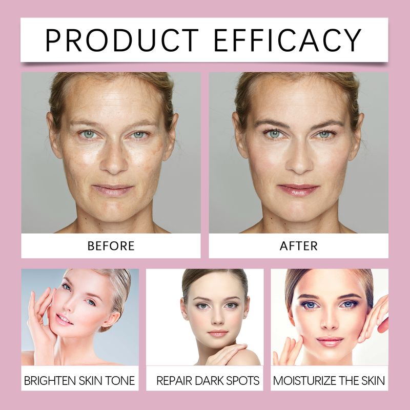 Hoygi Patch Repair Cream_voghion.com