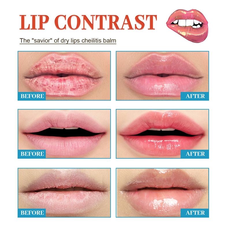Lip Repair Cream Moisturizes moisturizes the lips, removes dead skin, prevents dryness, and lightens lip lines_voghion.com