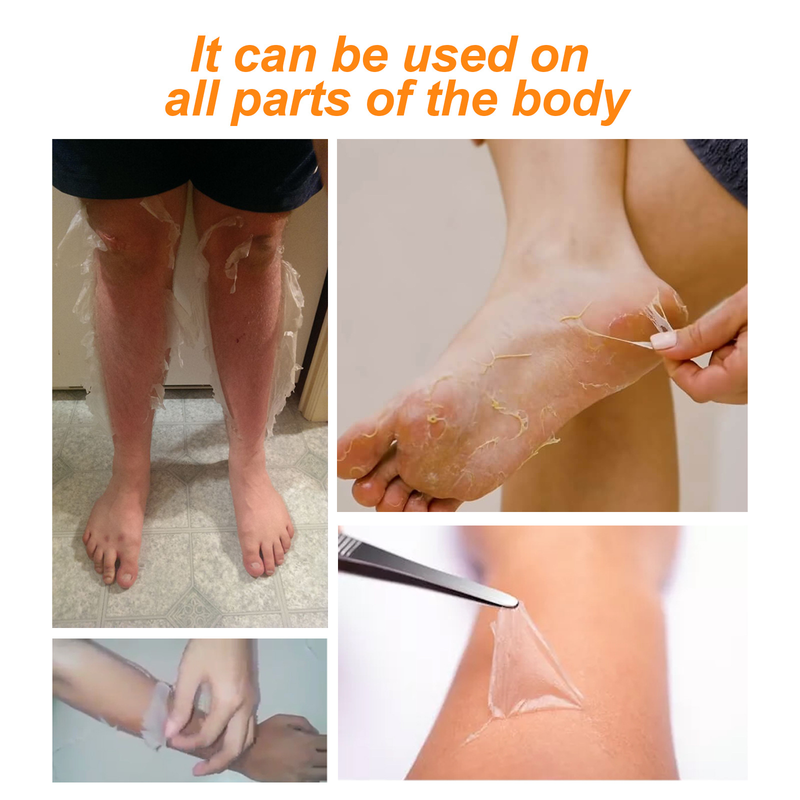 Orange Peel Eelhoe Exfoliating for Removing Black, White, Moisturizing, Brightening Skin, and Desalinating Mel_voghion.com