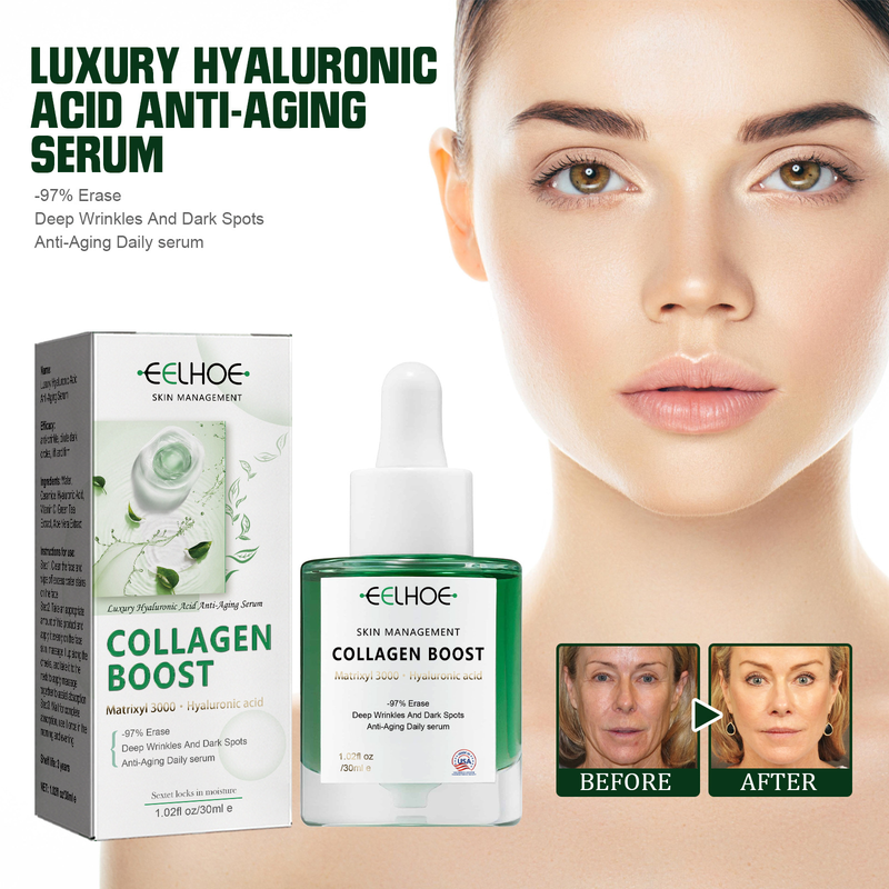 L'essenza antirughe all'acido ialuronico EELHOE riduce le linee sottili, idrata e rassoda la pelle del viso_voghion.com