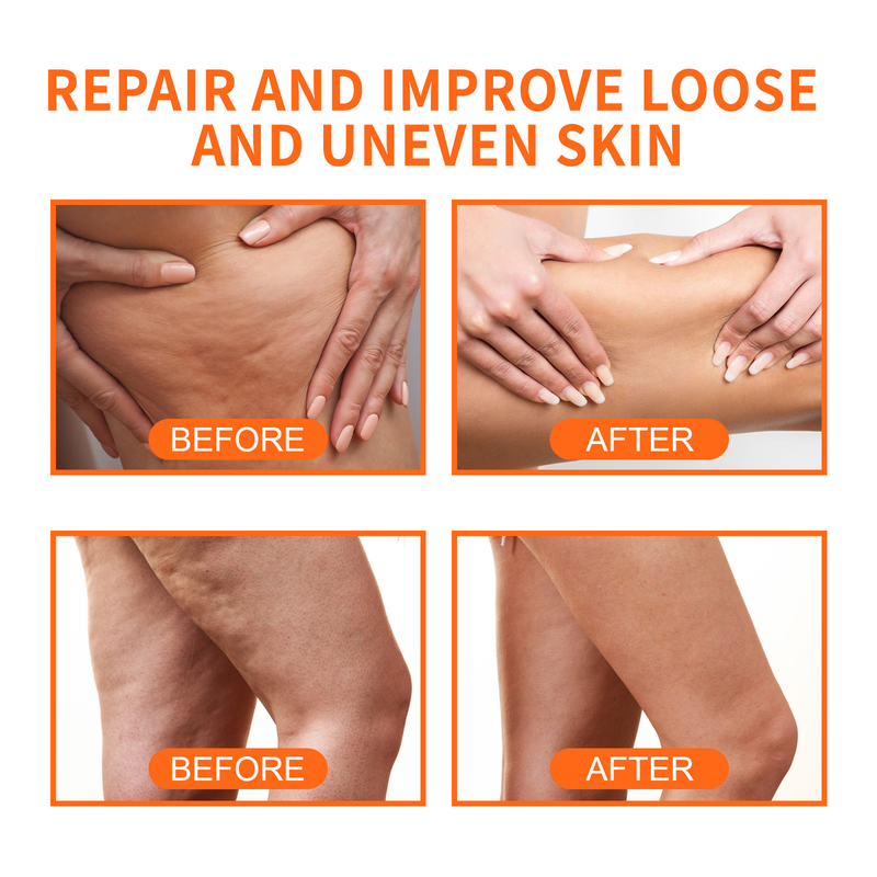 Reiniging Body Scrub Crème Anti Cellulite Lifting Verstevigende Huid Rimpel Remover Whitening Exfoliërende Verhelderende Body Cream 100g_voghion.com