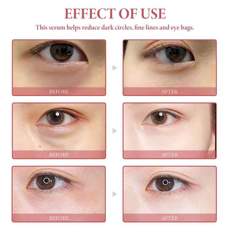 OceanAura Black Circle Lightens Fine Lines Daily Moisturizing And Firming Skin Eye Essence_voghion.com