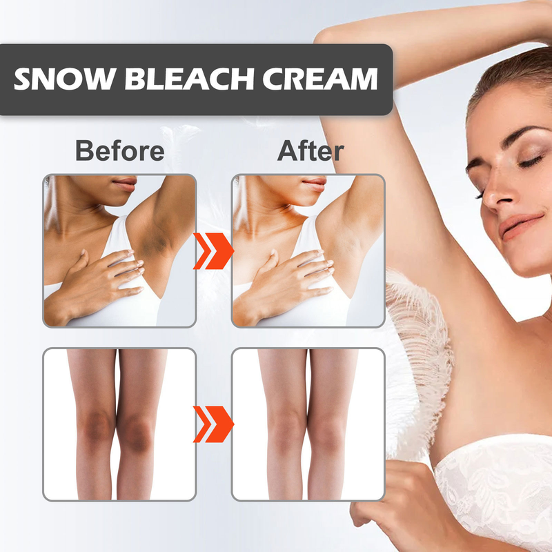 EELHOE Whitening Cream Fades darkening of joints on elbows, knees, armpits, moisturizes, brightens, whitens and beautifies the skin._voghion.com