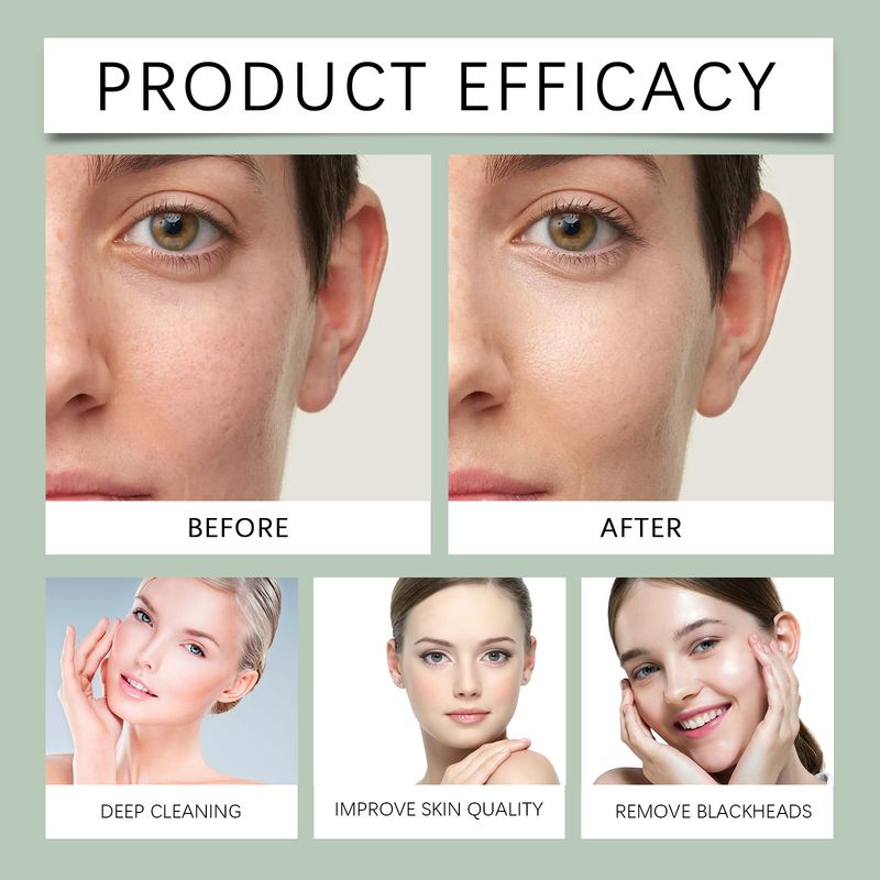 Hoygi Moxa Mud Mask Stick Deeply Cleans Pores, Brightening Skin, Firming, Smoothing And Refreshing Mask Stick_voghion.com