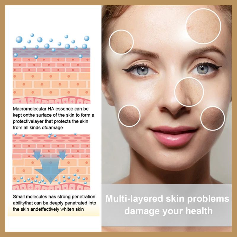 Gözenek Küçültücü Serum Nemlendirici Tonik Sivilce Lekelerini Giderir Gözenekleri Pürüzsüzleştirir Kuru Yağ Kontrolü Aydınlatır Akne Tedavisi Esans_voghion.com