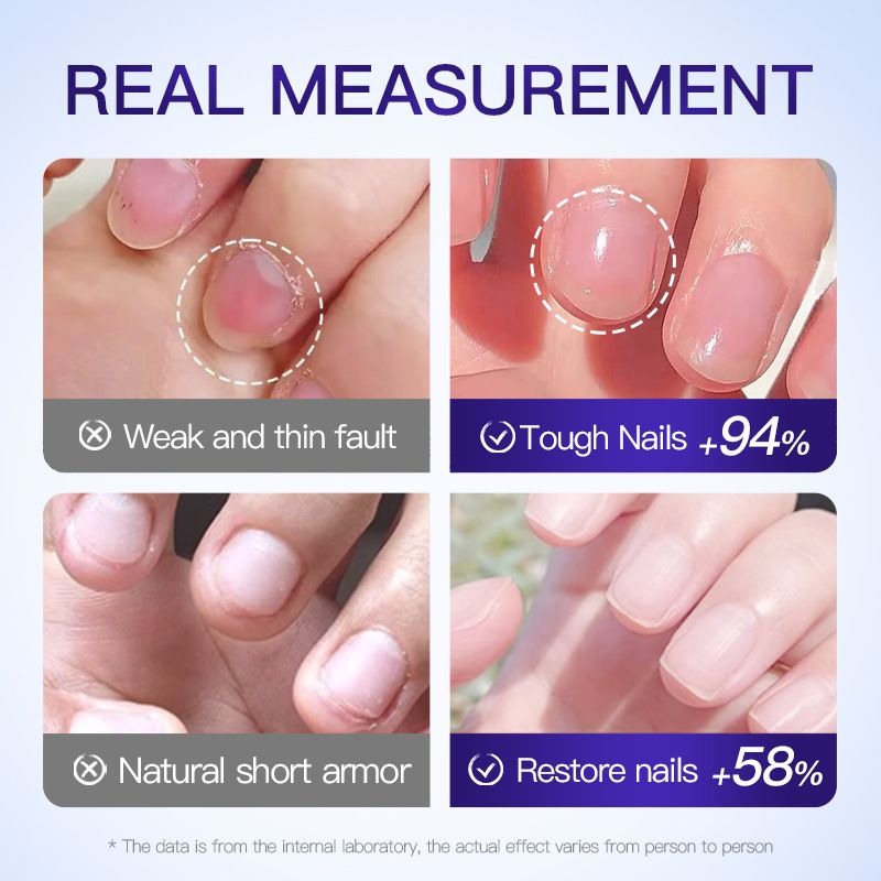 Vollständiges Englisch SADOER Nährende Nagelpflege Multi-Effekt Hautweichmachende Feuchtigkeitsessenz_voghion.com