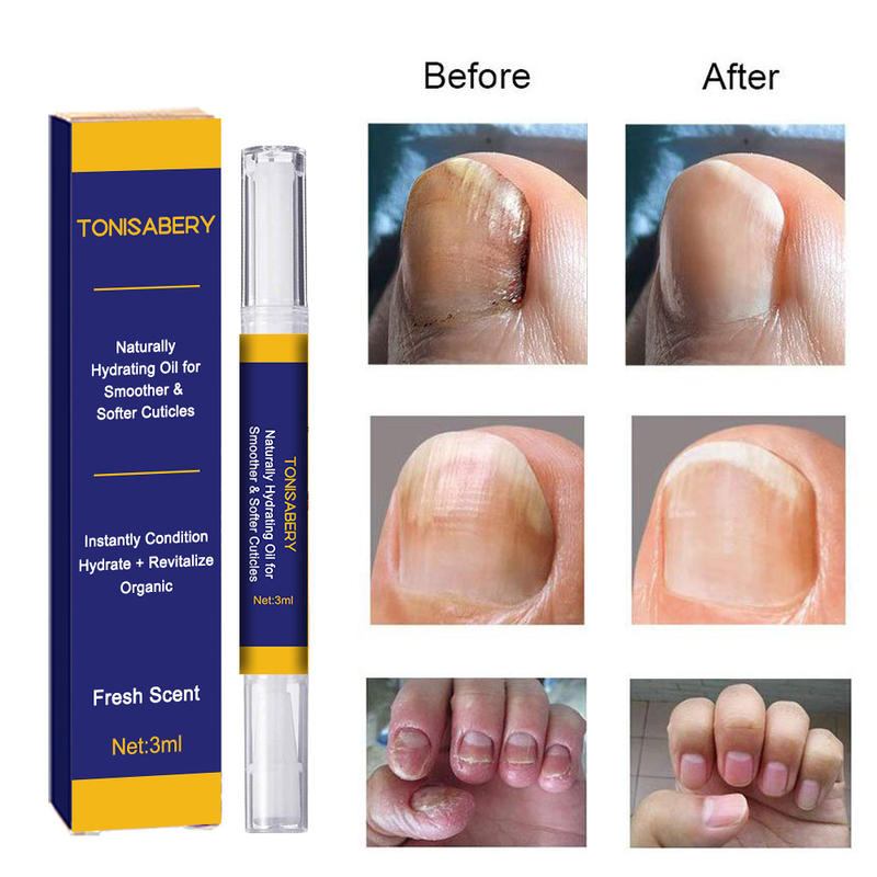 Nail gray herbal nail solution, one stroke bright repair pcs/box biological care solution across_voghion.com