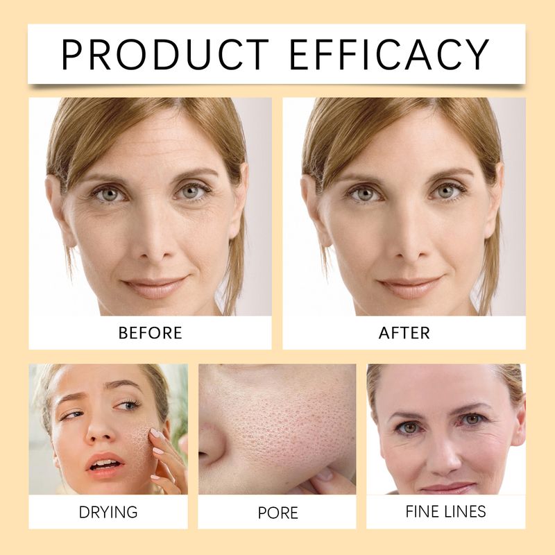 OUHOE Turmeric & Kojic Soap, Gentle Cleansing Skin Moisturizing Facial Body Care Soap_voghion.com