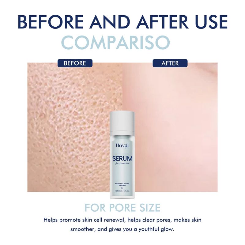 Hoygi Serum For Pore Size, Moisturizing And Reducing Dark Spots Pores Delicate And Smooth Skin Whitening_voghion.com