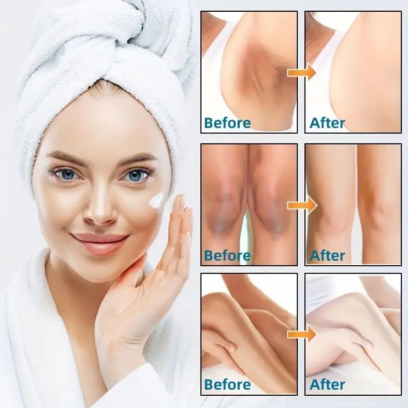 Dark Spot Correction Lightens Melanin And Brightens Face Cream Body Cream_voghion.com