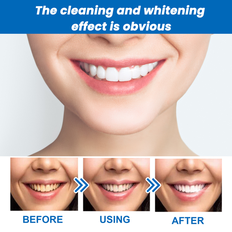 Beautiful Whitening Toothpaste Cleans Tooth Dirt, yellow Stains, and Plaque Whitening, Protects Teeth, and Breath Re_voghion.com