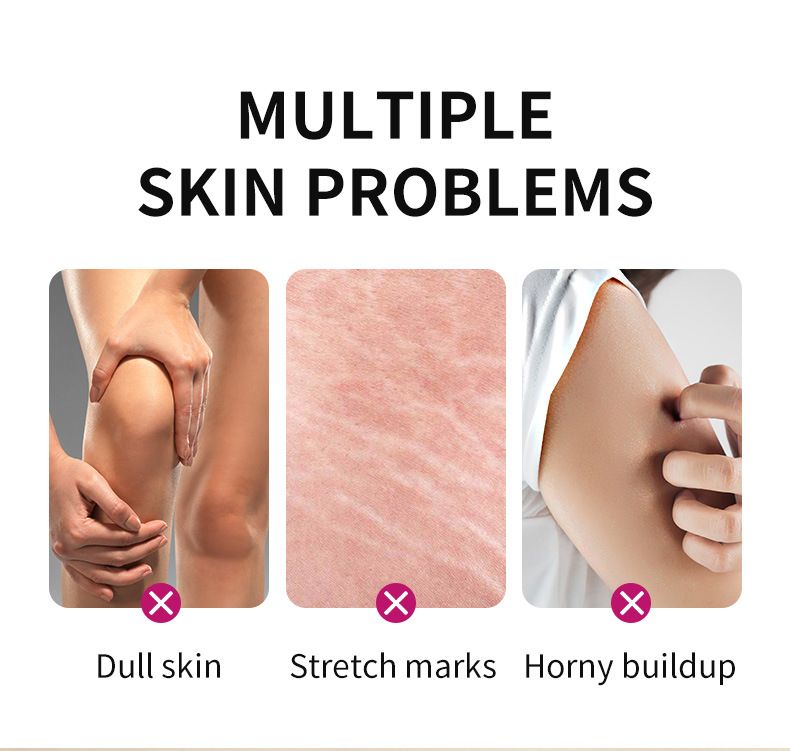 Voetverzorging Engelse Peeling Olie voor Handen en Voeten EXTRA STERKE PEELINGOLIE_voghion.com