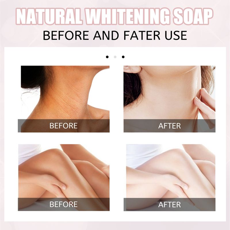 EELHOE Bath Soap, Acne Removal Moisturizing Brightening Skin Body Cleansing Soap_voghion.com