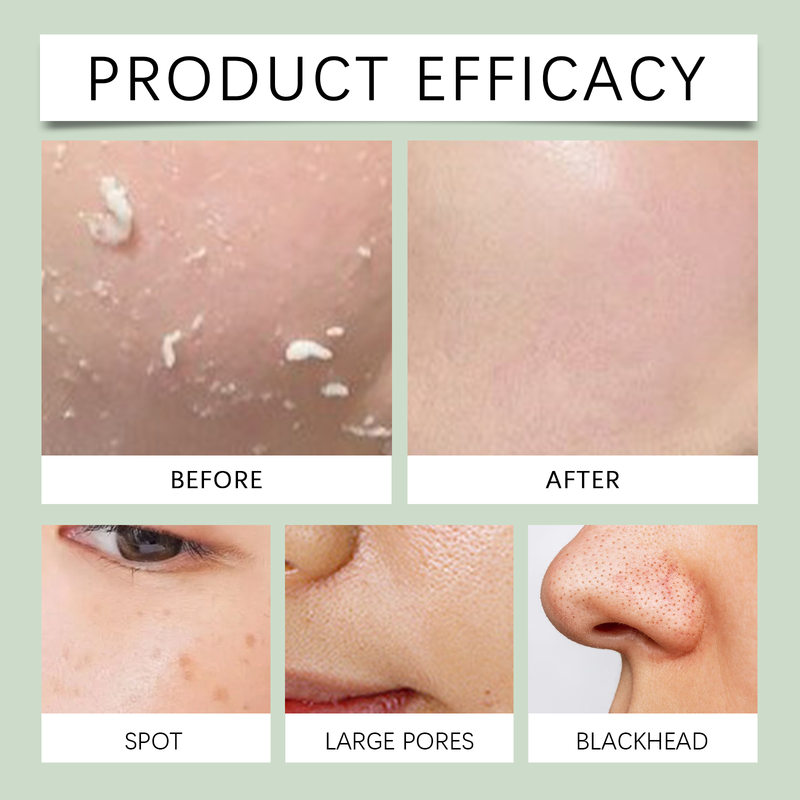 West&Month Purifying Exfoliating Gel Improves Dull Dryness Deeply Cleans Pores Brightening Skin Firming_voghion.com