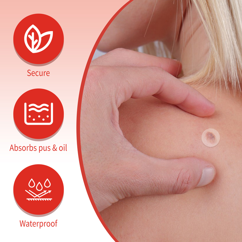 Removing Beautiful Verruca Set Skin Repair and Nevus Removing Patch Chicken Eyes, Barbs, Warts, Meat Granules Smooth B_voghion.com