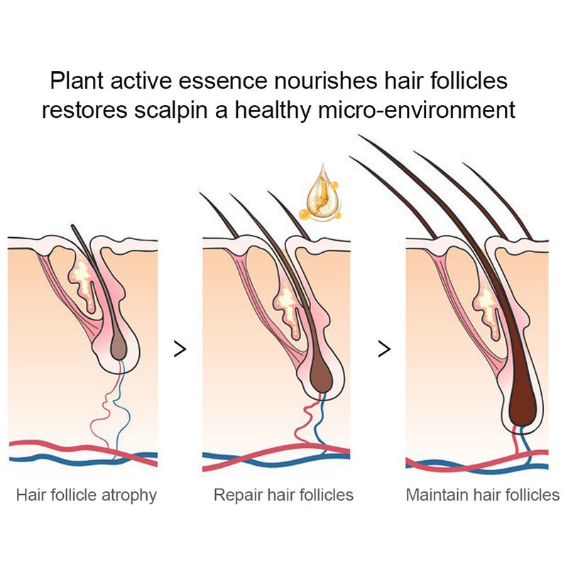 30ml Yüz Kılı Büyümesi Sakal Büyüme Esansiyel Yağı Erkek Sakal Değiştirici Ürün Frizz'i Hızlı İyileştirir Güçlü Saç Büyüme Sıvısı_voghion.com