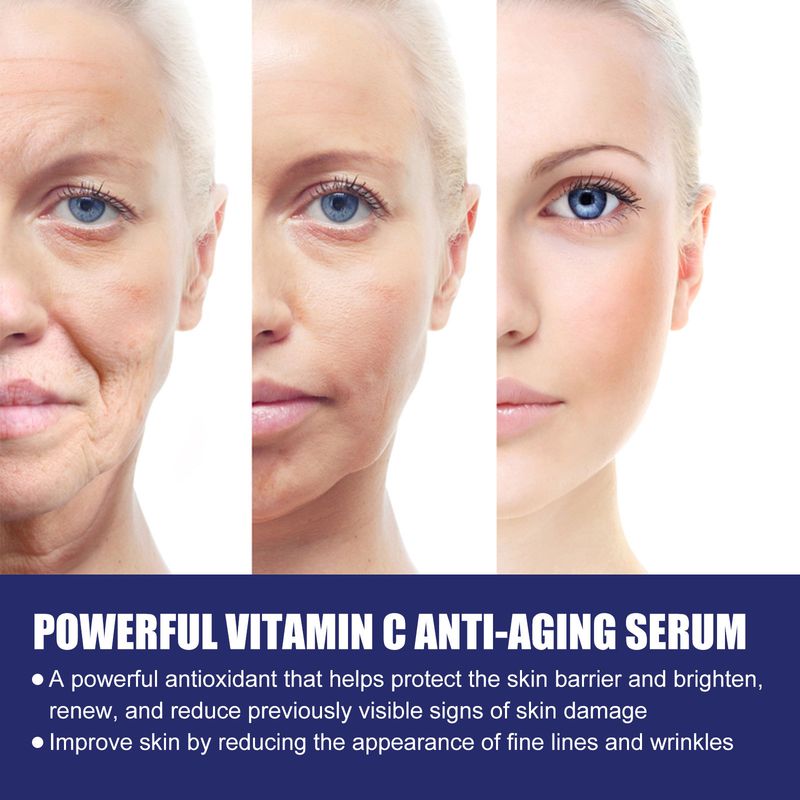 EELHOE Vitamin C Anti-Aging Serum, Moisturizing, Hydrating And Lightening Fine Lines, Raising Head Lines, Firming And Anti-Aging Essence_voghion.com