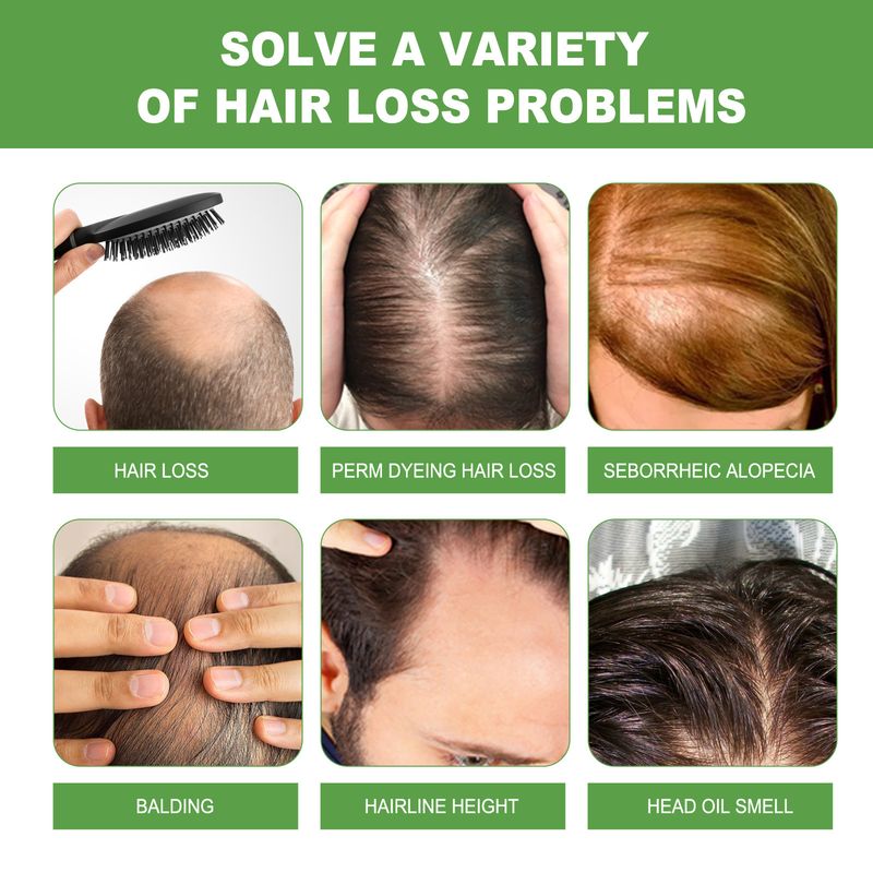 Rosmarin-Shampoo, Haarwachstum, Tiefenreinigung, Kopfhautbehandlung, Ölkontrolle, Stärkung der Haarwurzeln, Anti-Haarausfall-Shampoo, 100 ml_voghion.com