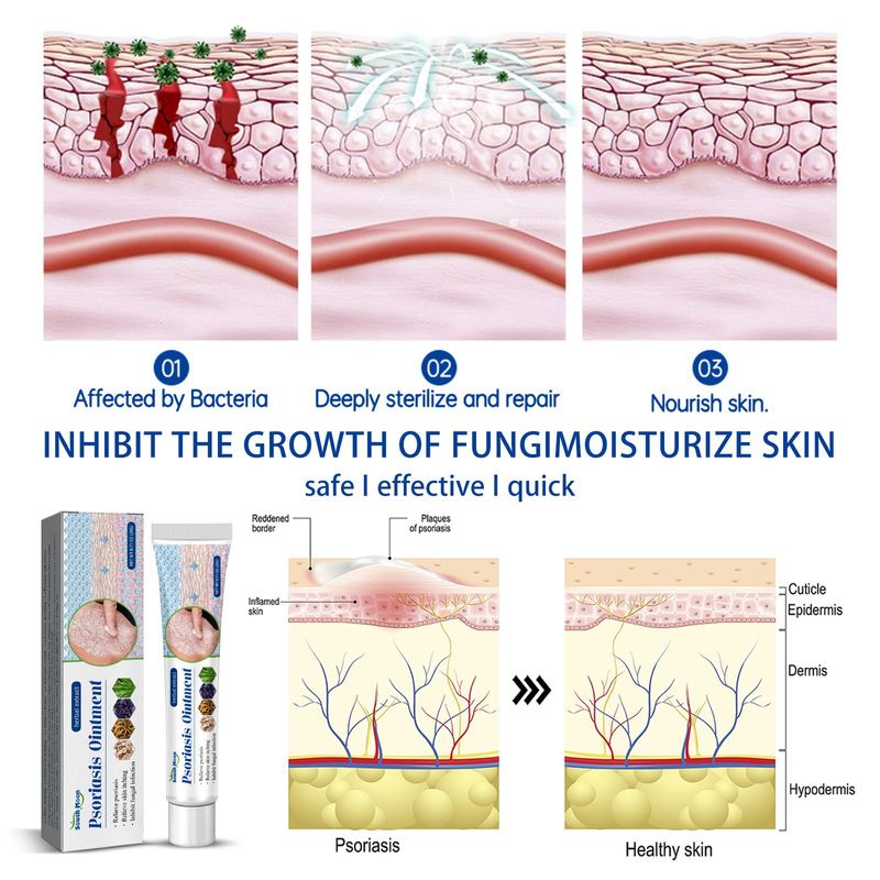 Antipruritic Cream Men's External Use Dry And Itchy Skin Care For Women_voghion.com
