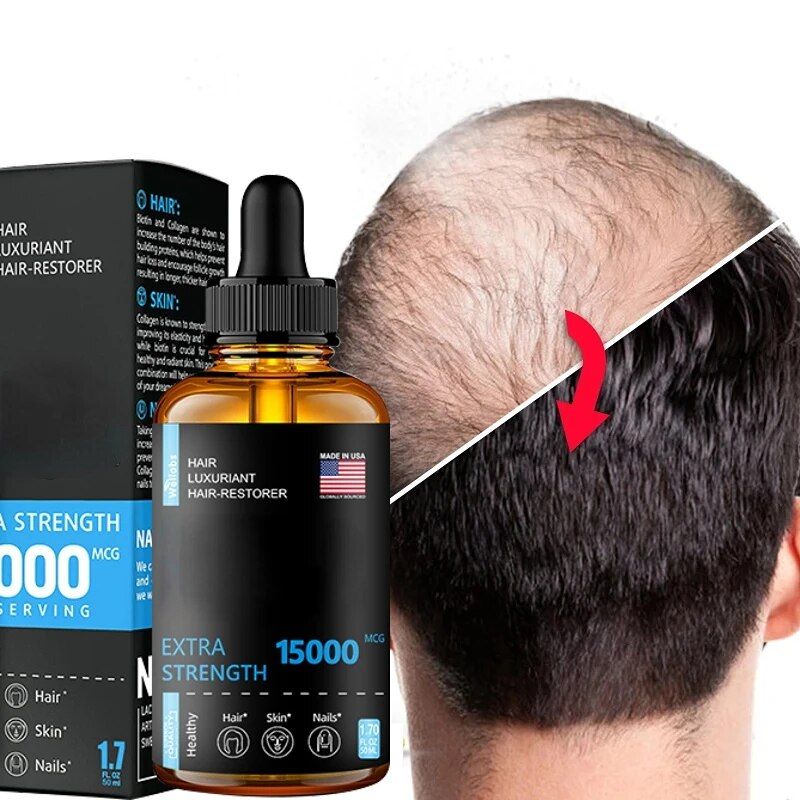 Hårtillväxt Eteriska oljor Produkter Ingefära Essens Snabb återväxt Serum Skäggtillväxtolja Håravfallsvård Skönhetsbehandling av hårbotten_voghion.com