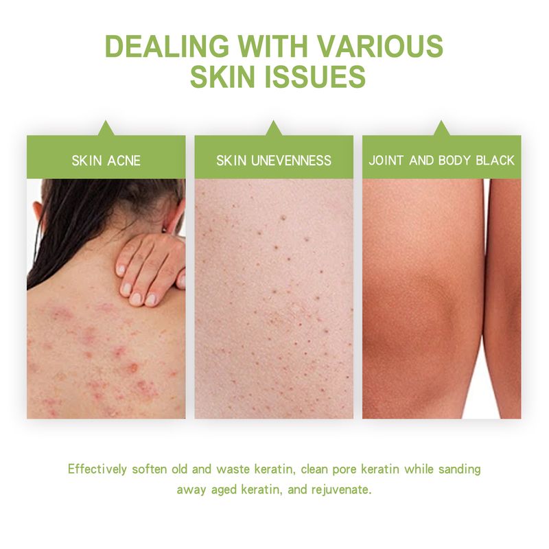 OCEAURA Avocado Body Exfoliating Scrub, Clear Skin Exfoliating Dead Skin Smooth And Brightening Skin Scrub_voghion.com