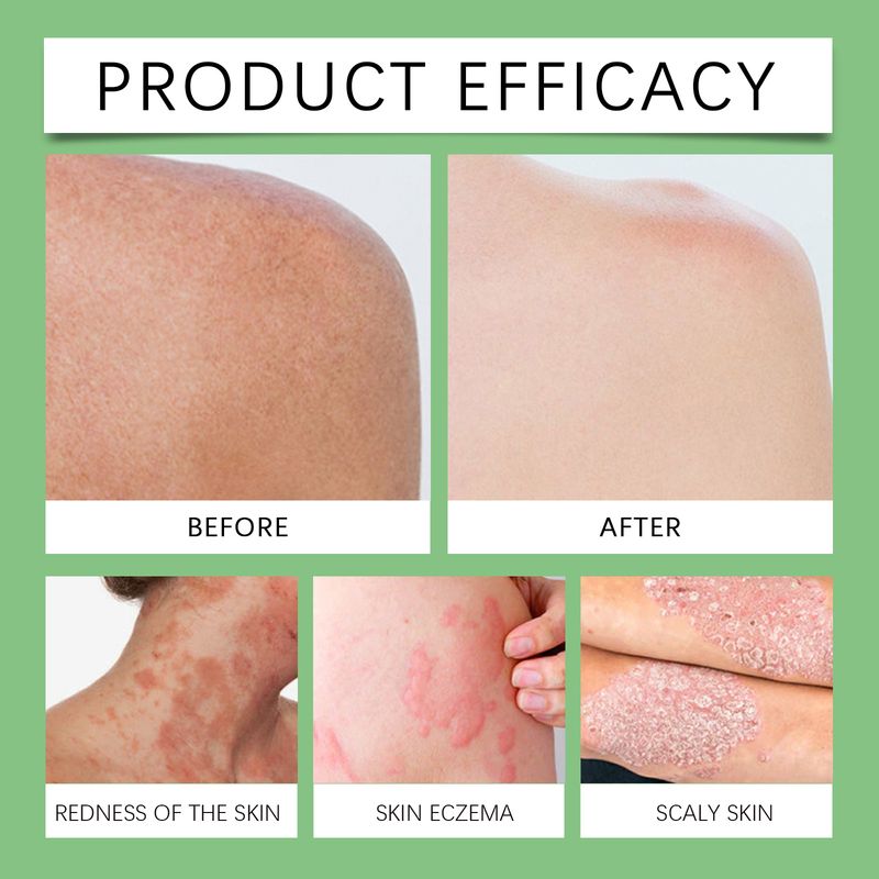 OceAura Pure Pine Tar Bath Soap Moisturizes And Cleanses Pores And Washes Delicate Skin Body Soap_voghion.com