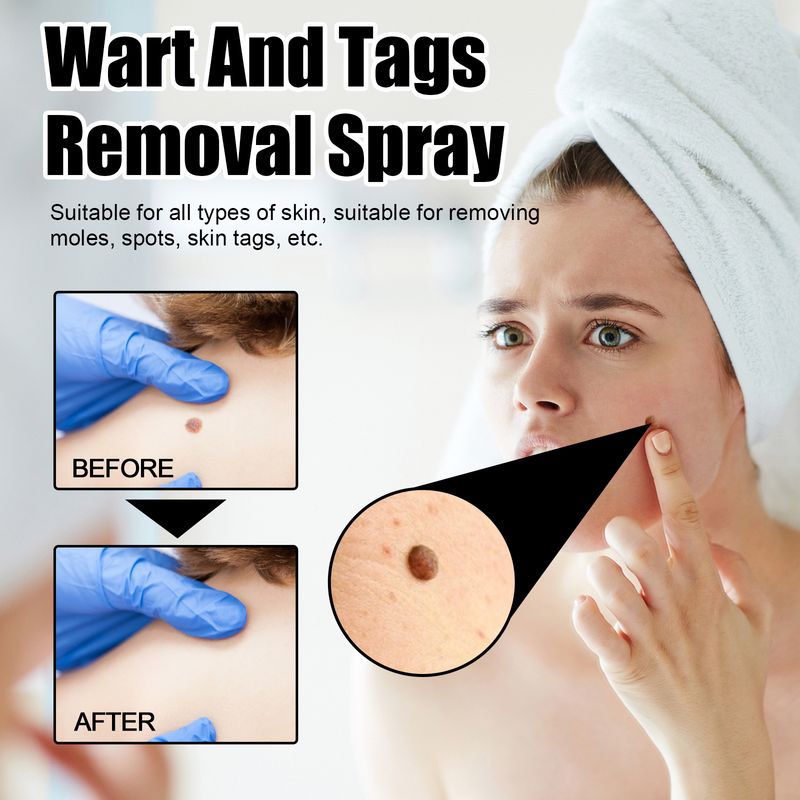 Spray Ximonth pentru îndepărtarea negilor și a alunițelor, curăță și estompează alunițele, spray reparator neted pentru piele_voghion.com